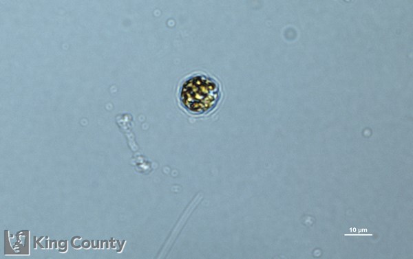 Photo of Heterosigma akashiwo